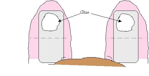 Place strip of tape up length of inside of ear